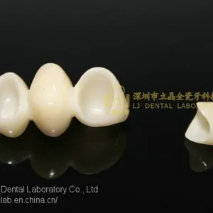 Dental Crown E.Max Ceramic, Porcelain Crown, Dental Veneers, Laboratoire Dentaire, Dentallabor, Laboratorio Dental, Dental Laboratory, Shenzhen LJ Dental Lab China thumbnail-5