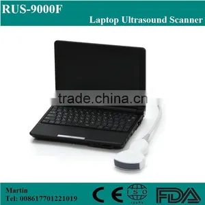 Lower Price Mini Laptop Medical Diagnose Ultrasound Scanner Machine-abdominal, Cardiac, Obstetrics, Gynecology thumbnail-1