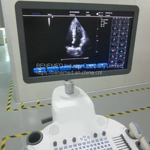 Trolly 2D Echocardiography Color Doppler Ultrasound Scanner Diagnosis Equipment thumbnail-2