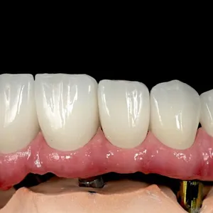 China Dental Laboratory - China Digital Dental Lab China Dental Lab Looks for Cooperation thumbnail-3