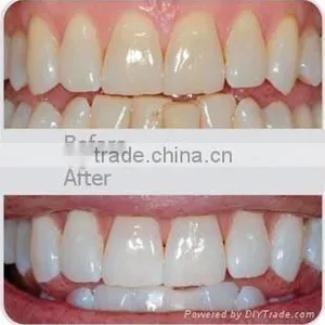 AYJ-J003B(CE) China Hot Selling Smart Clinic Dental Teeth Whitening Machine thumbnail-6