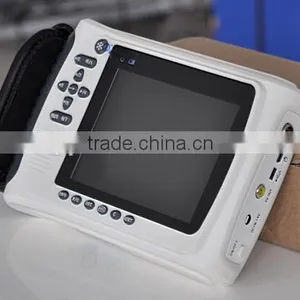 China Supplier Vet Handheld Ultrasound Scanner 2018V thumbnail-2