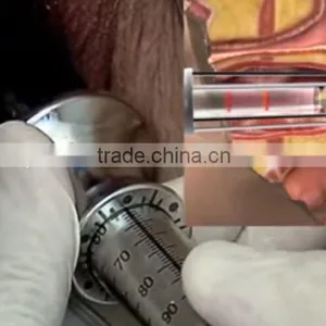 Beset Quality 40W Fractional Co2 Laser Vaginal Tightening Device thumbnail-6