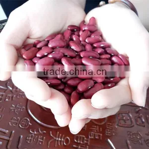20015 New Crop British Type Dark Red Kidney Beans thumbnail-3