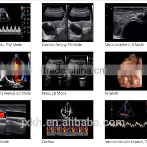 CE ISO Approved Medical 15 Inch LCD Monitor 3D 4D Trolley Color Doppler Ultrasound Scanner thumbnail-5
