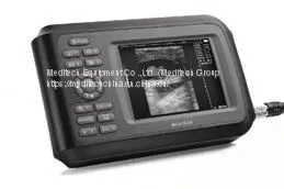 Handheld Ultrasound Scanner for Family Doctors, Clinic and Hospital thumbnail-1