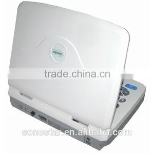 Sonostar Good Quality Handheld Portable Vet Ultrasound Scanner Pig Veterinary Ultrasound V10(SS-10V ) thumbnail-3