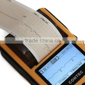 CE&ISO Price Single Channel Palm Handheld Human Use Electrocardiograph ECG Machine EKG Machine Price With Software and Printer thumbnail-4