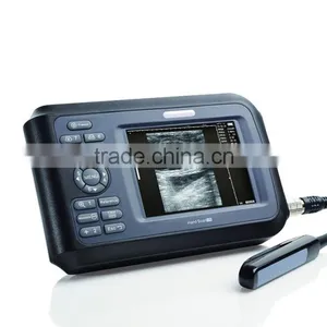 V8 Handle Type Digital Veterinary Ultrasound Scanner thumbnail-3
