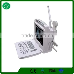 Imported 12 " LCD Handled USB B Ultrasound Machine in White Color thumbnail-1
