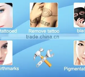 Laser Yag 2017 q Swiched for Tattoo and Pigmentation Removal thumbnail-6