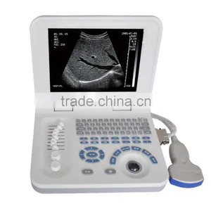 Ultrasound Equipments & Laptop Ultrasonic Machine 3018 thumbnail-4