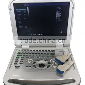 15 Inch Laptop Color Doppler 64G Image-storage Capacity Ultrasound Scanner for Hospital thumbnail-4