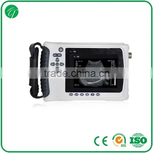 Cheap Chinese Convex Ultrasound Scanning Diagnostic Equipment 3018H thumbnail-1