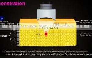 High Frequency Skin Care Machine (Hot In USA)2016 Poratble Liposunic Slimming Machine Beauty Equipment Hifu Portable thumbnail-2