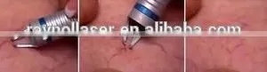 High Power Vascular RVein Removal Laser 980nm thumbnail-2