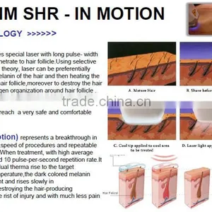 Permanent 808nm Diode Laser Bode Hair Removal With No Pain Arm / Chest Hair Removal thumbnail-3