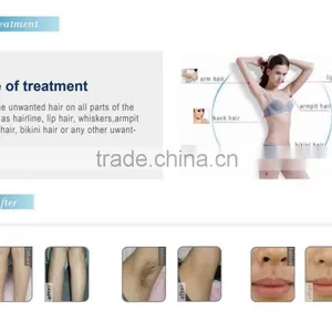 1-10HZ Newest 808nm Diode Laser Face Hair Removal Machine/810nm Portable Laser thumbnail-4