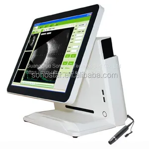 Cheapest Best Selling Portable Eye B Ultrasound Scanner a B Equipment thumbnail-1