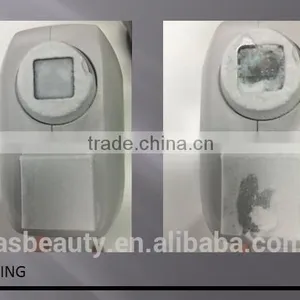 AC220V/110V Beauty Machine Laser Hair Removal Permanent Vertical Machine Diode Laser 808 thumbnail-4