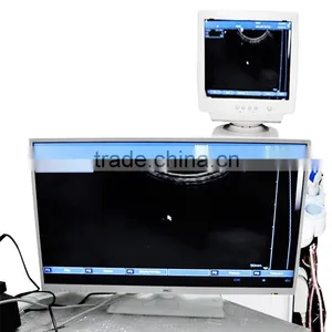 Medical Mobile Price Trolley Hospital Ultrasound Scanner Machine With Probe--RUS-9000C-Shelly thumbnail-5