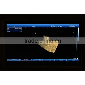10.4 Inch LCD Laptop Ultrasound Machine PC System 3.5Mhz Convex Probe 7.5MHz Linear Probe Portable Ultrasound Scanner Price thumbnail-6