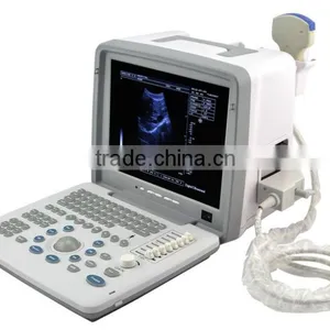 OEM Supply 12 Inch Laptop Ultrasound Scanner Ultrasonic Machine B Ultrasound Scanner for Sale thumbnail-3
