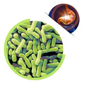 Wholesale Price High Activity Bifidobacterium Animalis Probiotic Supplements Powder Bulk For Gastrointestinal Nursing thumbnail-1