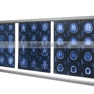 High Brightness X Ray LED Light thumbnail-1