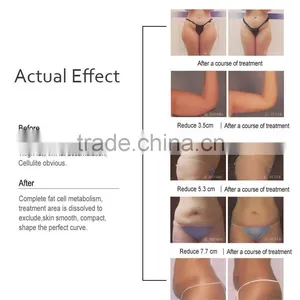 Beauty Salon Use Ultrasound Shap Fat Removal With CE Certificate thumbnail-6