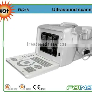 FN218 Full Digital B Model Ultrasound Probe Usb thumbnail-1