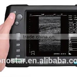V5 Palm Ultrasound Scanner(ultrasonic,black White,Imaging Sys thumbnail-3