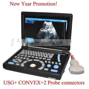 Promotion!!CE Approved Notebook Ultrasound Scanner With 3.5Mhz Multi-frequency Convex Probe RUS-9000E2 thumbnail-1