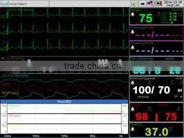 Best Price Promotion--Multi-parameter ICU Patient Monitor-CE/FDA Approved thumbnail-2