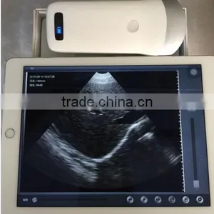 Factory Directly Supplies 2016 Wireless Ultraound Convex Probe -WBU01 thumbnail-2