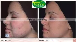 NEEM OIL PURE UNIVERSAL thumbnail-5