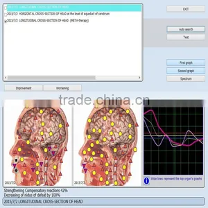 9d Nls Non Linear Diagnostic System 9d Nls Detector Tester Accuracy Above 98% Manufacturers thumbnail-4