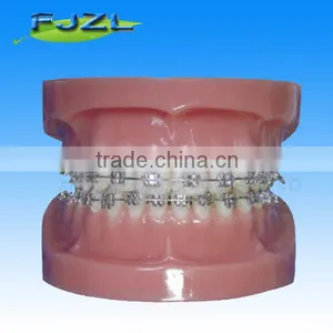 Orthodontic Teeth Model(normal Model),dental Orthodontic Models thumbnail-1