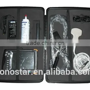 V5 Palm Ultrasound Scanner(ultrasonic,black White,Imaging Sys thumbnail-4