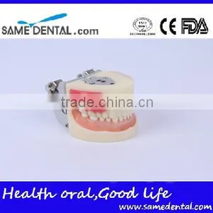 Abscess and Tooth Preparation Model School Teaching Demonstration thumbnail-1