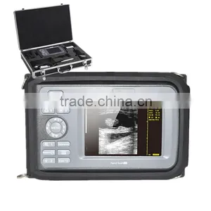 Cheap Price Portable Ultrasound Scanner With Battery Aluminium Box Suitable Hospital Clinic thumbnail-1