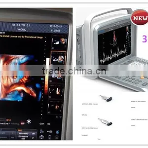 CE ISO Portable/laptop Color Doppler 3D/4D Ultrasound Diagnostic System Machine Clear Image thumbnail-1