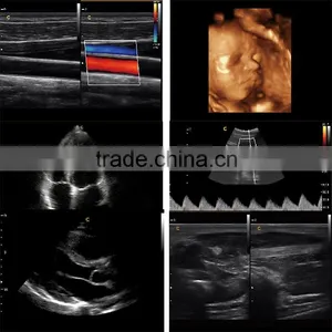 2016 Laptop/Portable 3D 4D Ultrasound Machine Color Doppler Diagnostic System thumbnail-4
