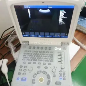 Laptop Diagnosis Color Ultrasound System thumbnail-2