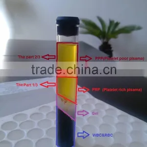 PRP Surgery PRP Tube With High Concentration Platelet 8ml,10ml,15ml thumbnail-2