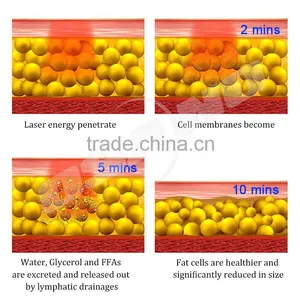 Best Lipo Laser Machine , Portable Lipolaser Slimming Machine thumbnail-6