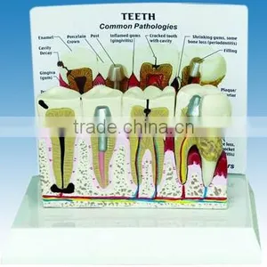 Teeth Model With Description Plate thumbnail-1