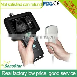 Sonostar Good Quality Handheld Portable Vet Ultrasound Scanner Pig Veterinary Ultrasound V6 thumbnail-1