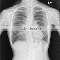 Laser FilmDry Medical Film thumbnail-4