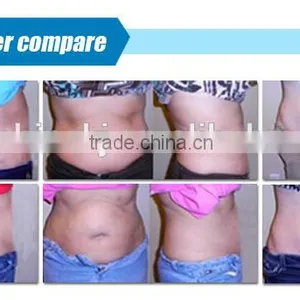 CE Approved 5 in 1 Weight Loss Cavitation rf Portable Ultrasound Device thumbnail-6